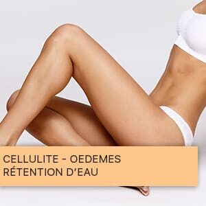 Cellulite - Œdèmes - rétention d’eau